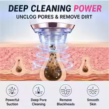 Rechargeable  Blackhead Remover