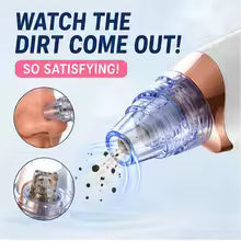 Rechargeable  Blackhead Remover